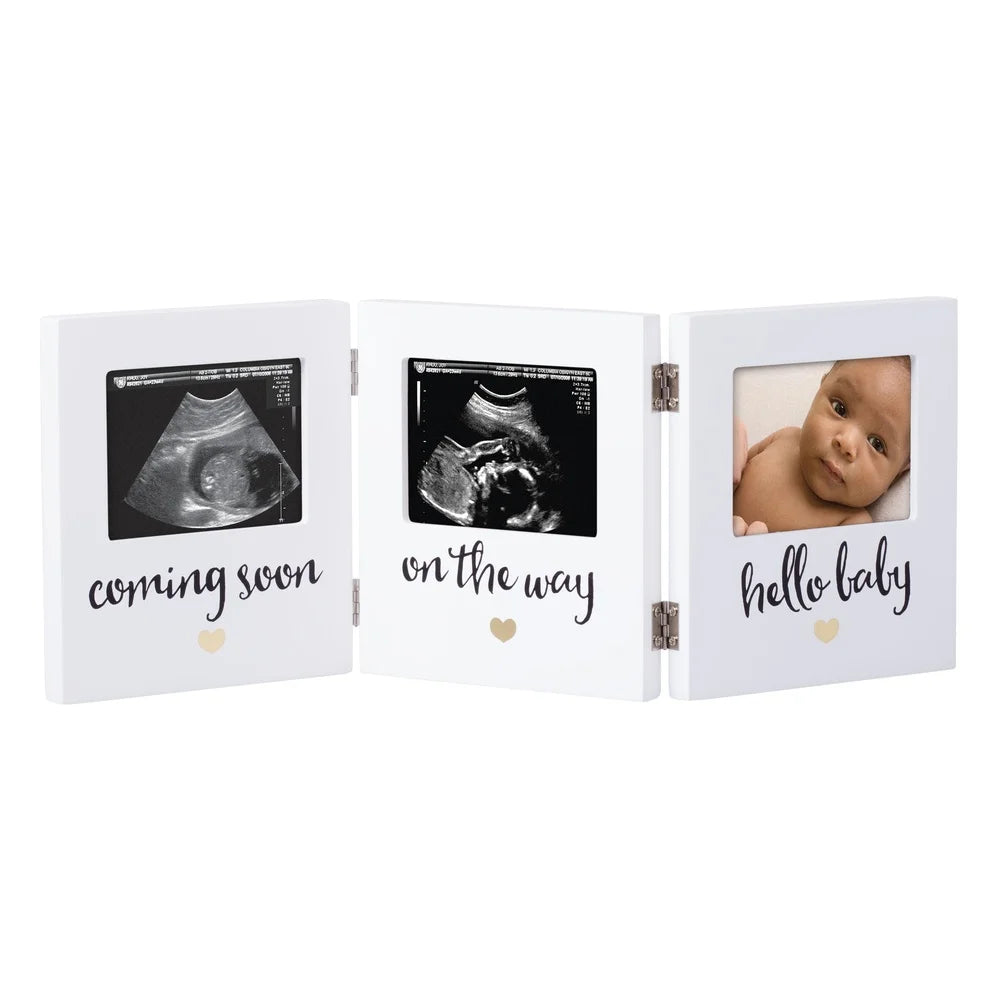 Triple Sonogram Keepsake Baby Picture Frame White Hinged Display Ultrasound Pregnancy Journey Ideal Gift Expecting Parents